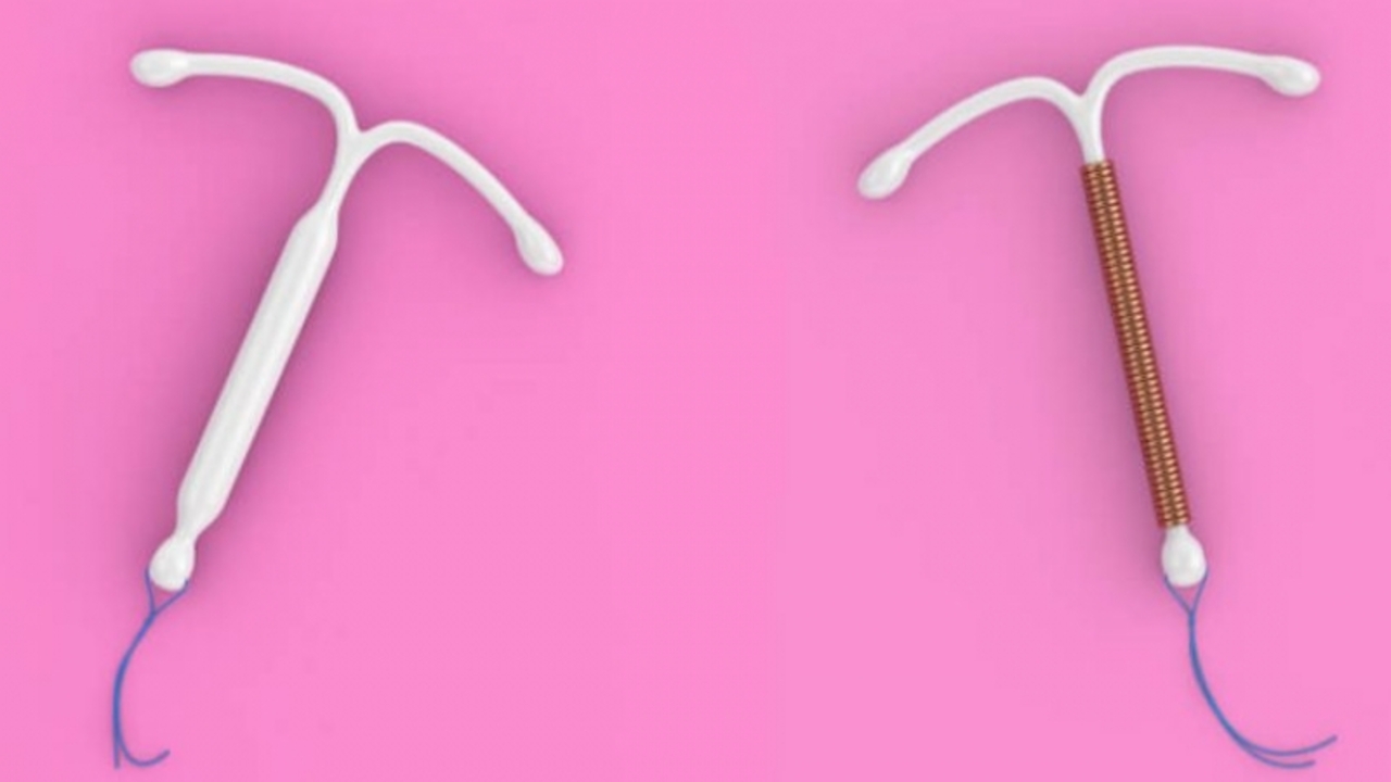 DIU hormonal para endometriose passa a ter cobertura obrigatória pelos planos de saúde